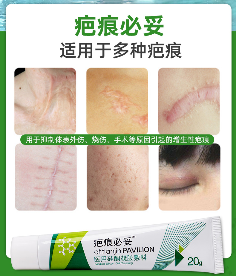 医用硅酮凝胶敷料(疤痕必妥)(疤痕必妥)(医用硅酮凝胶敷料(疤痕必妥))